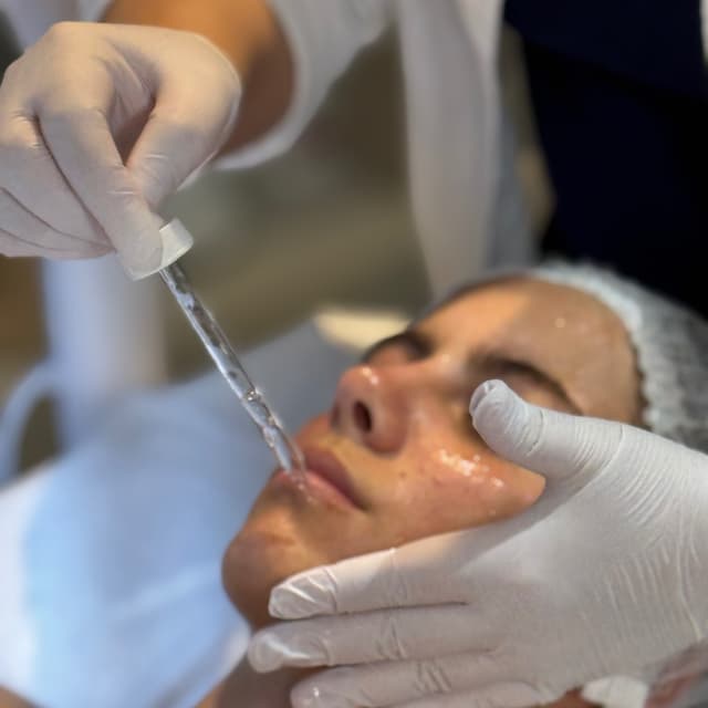Microneedling Treatment+ PDRN at B&G by Tania Loiola in Celebration, FL
